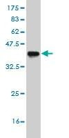 Anti-ASCL1 Antibody