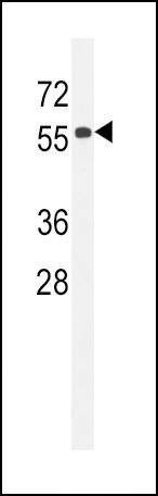 Anti-CC85C (N-term) Antibody