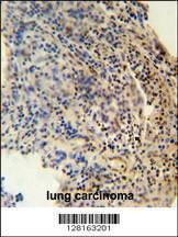 Anti-ZNF197 (N-term) Antibody