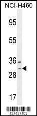 Anti-WBSCR27 (N-term) Antibody