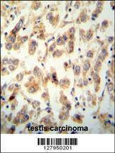 Anti-TTC16 (N-term) Antibody