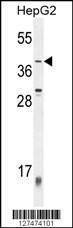 Anti-ZNF763 (C-term) Antibody