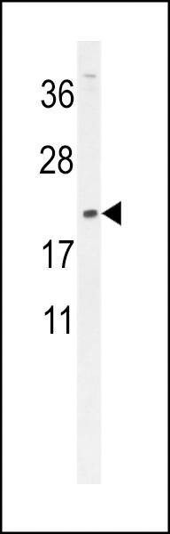 Anti-DMRTC1 (N-term) Antibody