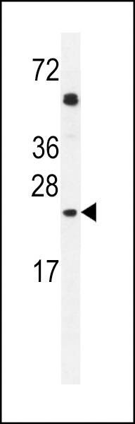 Anti-GOLGA2L1 (C-term) Antibody