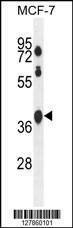 Anti-SPATA2L (Center) Antibody