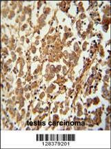 Anti-SPATC1 (N-term) Antibody