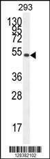 Anti-IGSF5 (N-term) Antibody