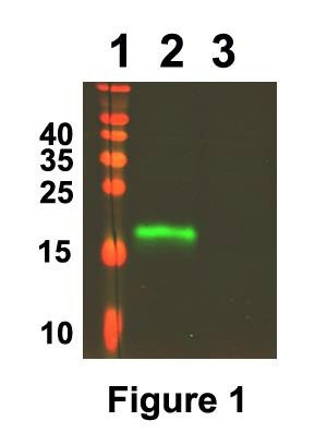 Recombinant Human HE4 Protein, HeLa Cell Line