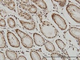 Anti-ATF2 Antibody