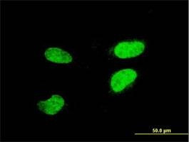 Anti-ATF2 Antibody