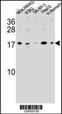 Anti-S100Z (N-term) Antibody