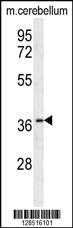Anti-OR10X1 (Center) Antibody