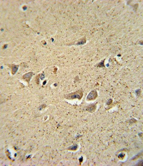 Anti-SCN1B (N-term) Antibody