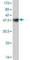Anti-ATF3 Antibody