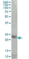 Anti-ATF3 Antibody