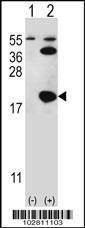 Anti-UBC9 (UBE2I) (N-term) Antibody