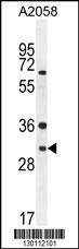 Anti-ARV1 (N-term) Antibody