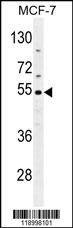 Anti-CES2 (Center) Antibody
