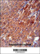 Anti-CES2 (Center) Antibody