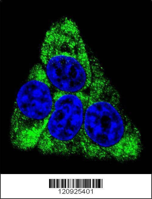 Anti-BCKDHB (N-term) Antibody