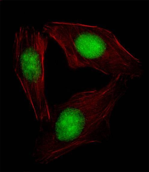 Anti-SREBF2 (Center) Antibody