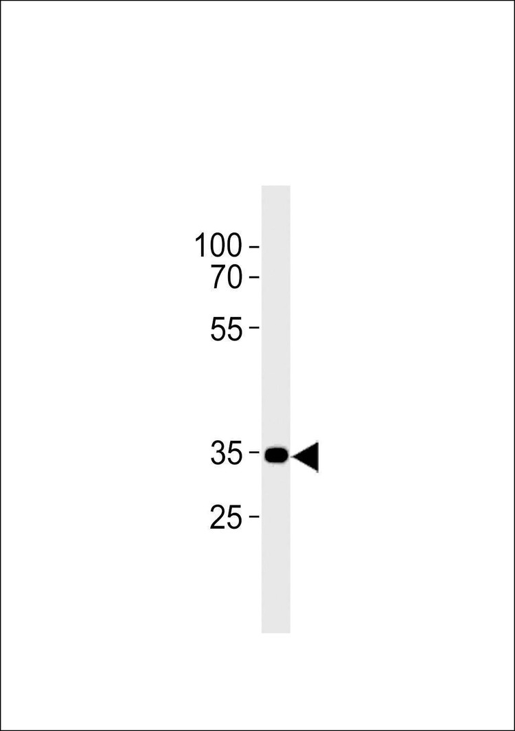 Anti-CB2 (C-term) Antibody