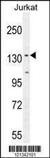 Anti-PPP1R3A (Center) Antibody