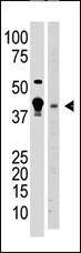 Anti-MBD2 (N-term) Antibody