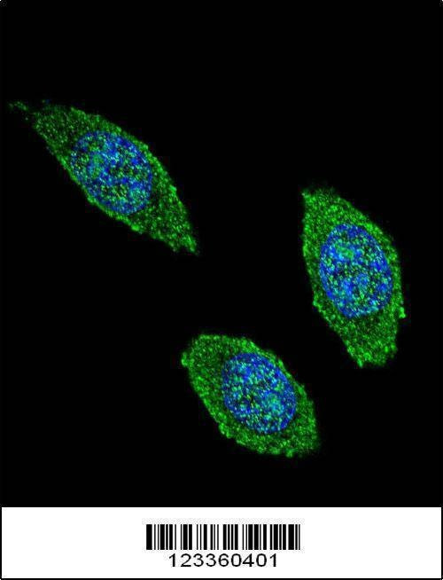Anti-CSF2 (Center) Antibody