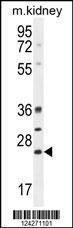 Anti-BCL10 (N-term) Antibody