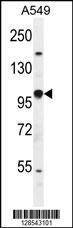 Anti-EPAS1 (N-term) Antibody