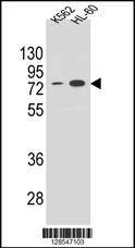 Anti-ENTPD3 (C-term) Antibody