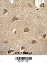 Anti-ENTPD3 (C-term) Antibody
