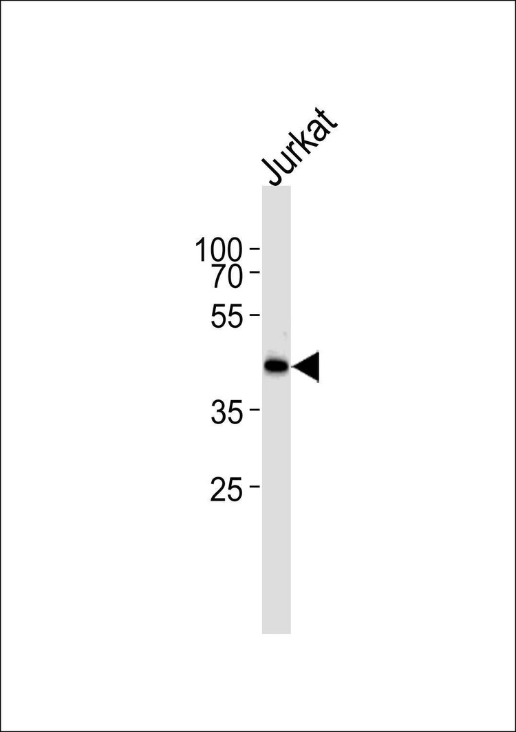 Anti-ETS1 (N-term) Antibody