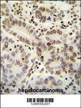 Anti-HIST1H2BJ (Center) Antibody