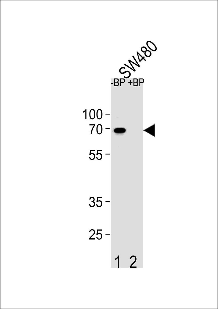 Anti-ETV5 (N-term) Antibody
