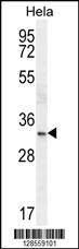Anti-NKX2-1 (N-term) Antibody