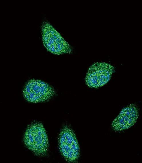 Anti-SERPINA6 (Center) Antibody