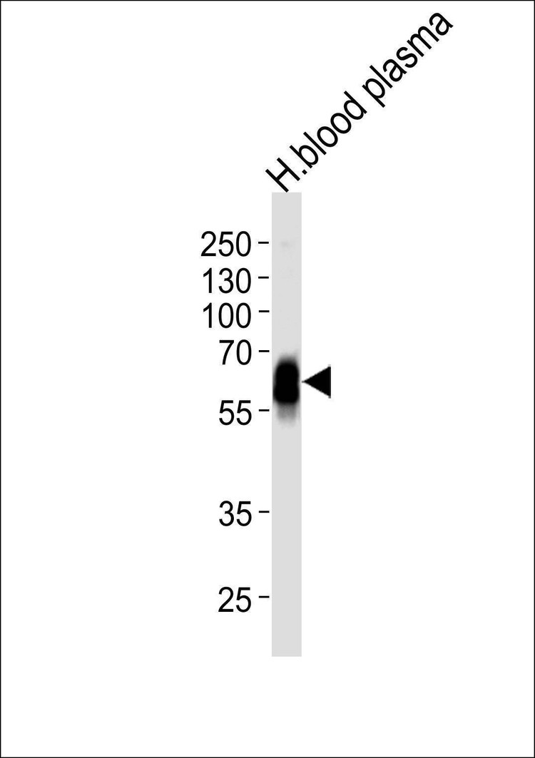 Anti-SERPINA6 (Center) Antibody