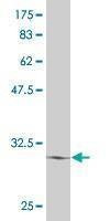 Anti-ATOH7 Antibody