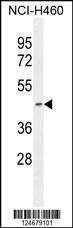 Anti-PDHA2 (Center) Antibody