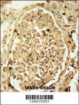 Anti-PDHA2 (Center) Antibody