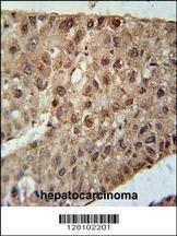 Anti-ZC4H2 (C-term) Antibody