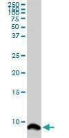 Anti-ATOX1 Antibody