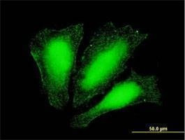 Anti-ATOX1 Antibody