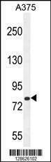 Anti-CB086 (C-term) Antibody