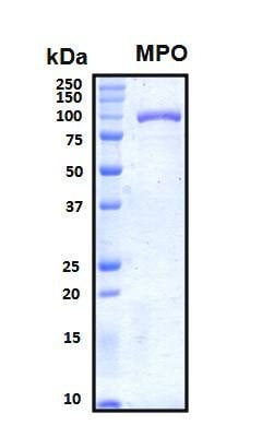 Recombinant Human Myeloperoxidase (MPO) Protein, Biotinylated