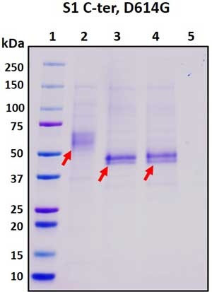 Recombinant SARS-CoV-2 S1 Subunit Protein, C-terminal, D614G muant