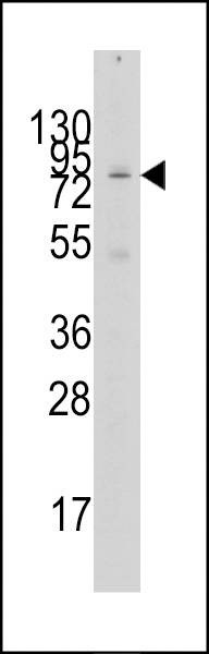 Anti-GCN5 (N-term) Antibody