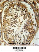 Anti-SRAC1 (C-term) Antibody